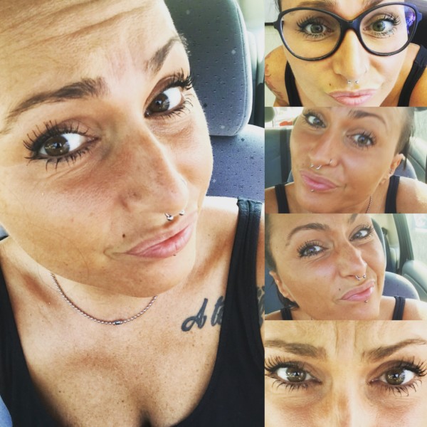 sclerosi multipla notte